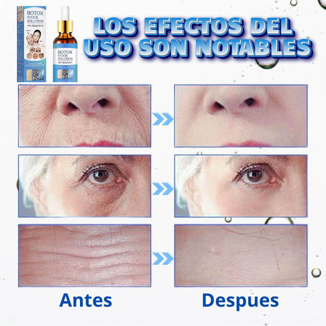 Botox Suero Antiarrugas Promo 2x1 🎁