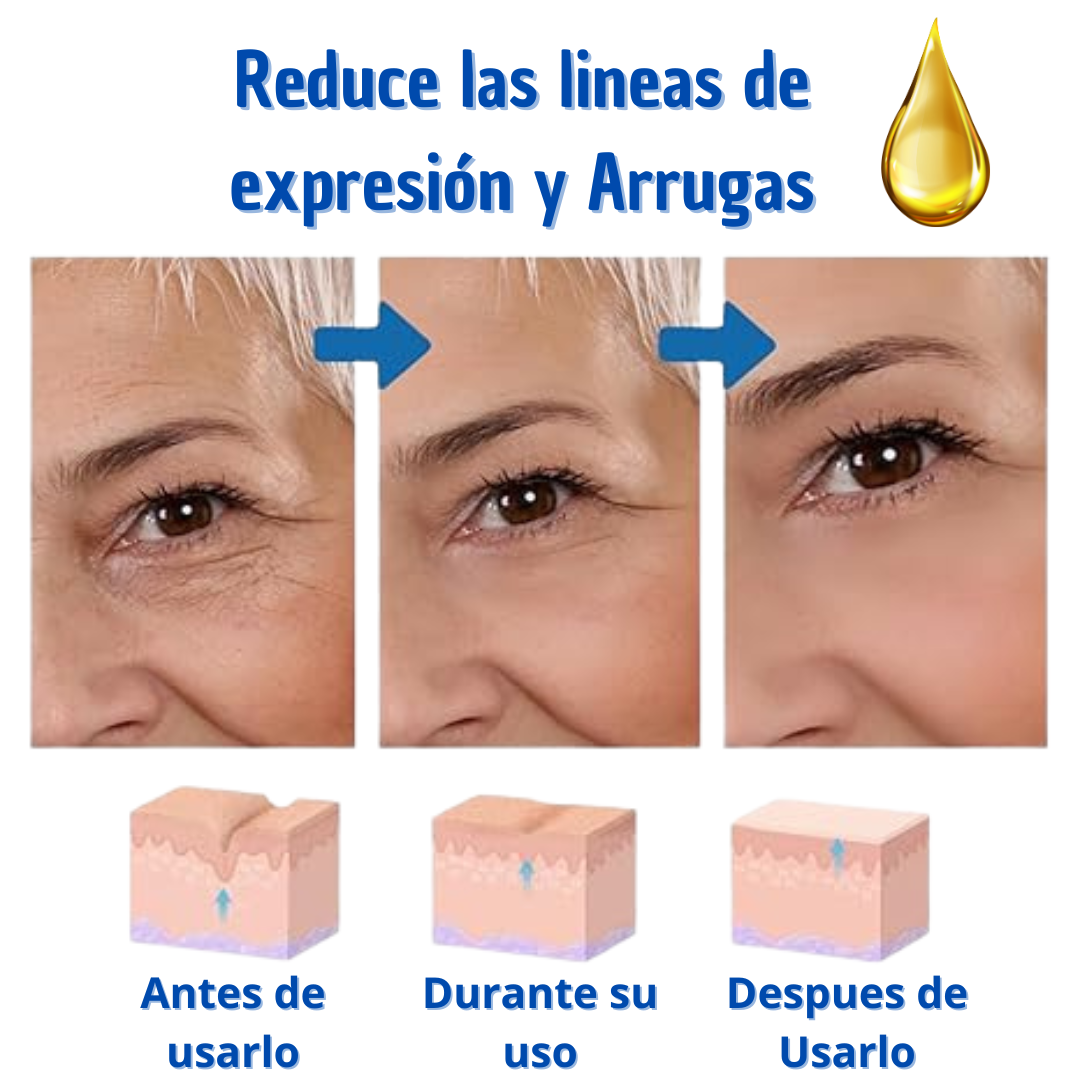 Botox Suero Antiarrugas Promo 2x1 🎁